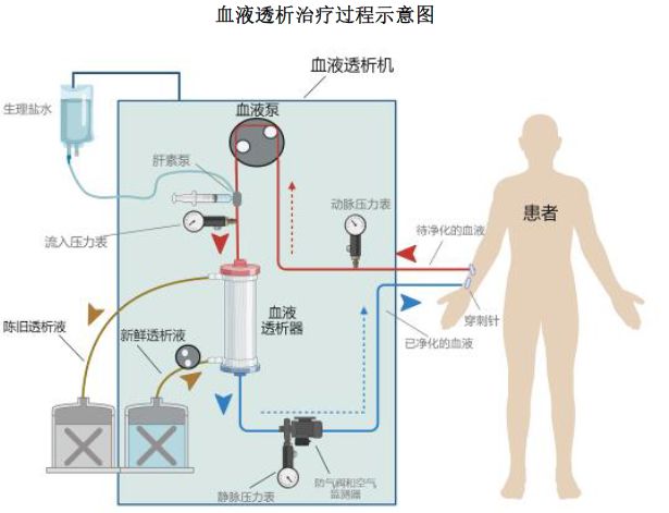 血透龙头打出了逆风牌