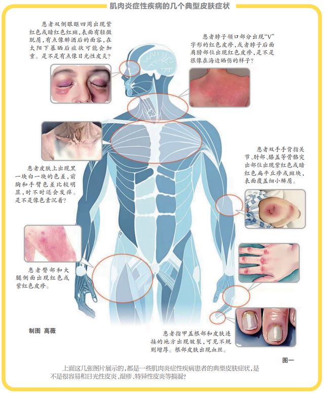 警惕致命皮肤病！19岁女星从确诊到去世仅10天